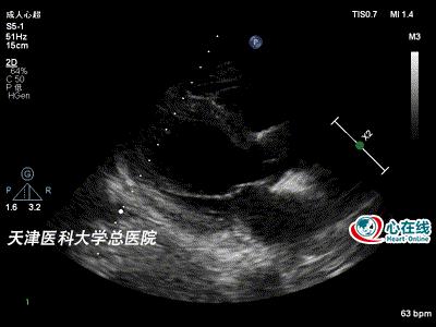 多维度视角下的冠心病最新图论述